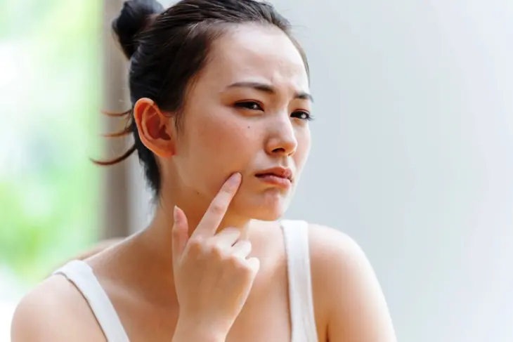 Kulit Kering dan Sensitif? Ini 5 Produk Skincare yang Harus Dihindari