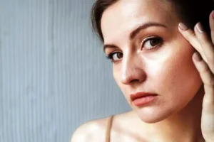 Kulit Wajah Kering dan Bersisik? Ini 5 Penyebab & Solusi Tepat!