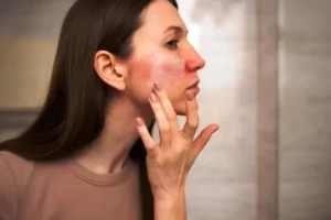 Kulit Wajah Kering vs Berminyak: Kenali Perbedaan dan Cara Merawatnya