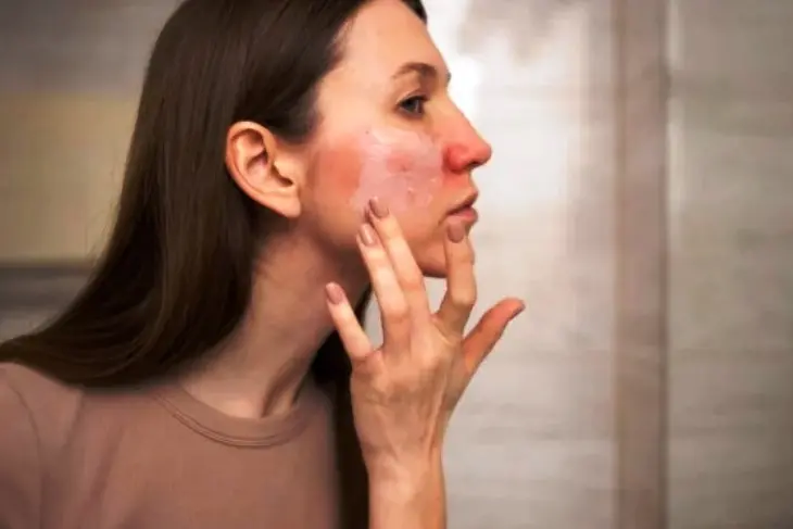 Kulit Wajah Kering vs Berminyak: Kenali Perbedaan dan Cara Merawatnya